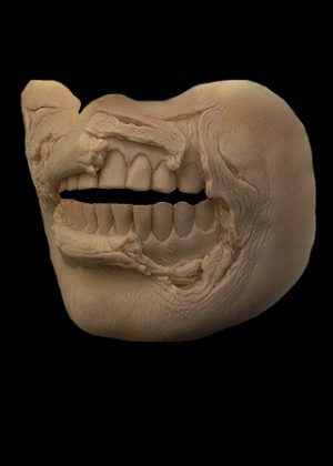 exposed teeth zombie prosthetic Drawing Teeth, Halloween Prosthetics, Zombie Pics, Sculpture Reference, Makeup Ideas For Halloween, 3d Makeup, Scary Halloween Decorations Diy, Facial Scars, Prosthetic Makeup