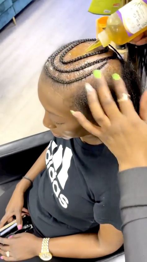 Braids That Cover Bald Spots, Braided Bald Head, Bald Head Braids, Bald Braids, Ugly Braids, Head Braid, Inspiration Videos, Bald Spot, Bald Head