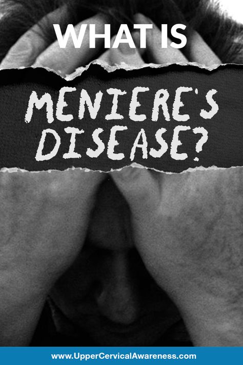 If you have never heard of Meniere’s disease, you are not alone. Only about 0.2% of people are affected by this rare vestibular disorder. However, that number may be a little misleading as tens of thousands are diagnosed each year in the US alone. #VertigoRelief #DizzinessRelief #VertigoSufferer #VertigoTips #NaturalRelief #DrugFreeRelief Menieres Disease Diet, Vestibular Disorder, Meneires Disease, Upper Cervical Chiropractic, Hearing Problems, Congenital Heart Defect, Disease Symptoms, Rare Disease, Chiropractic Care