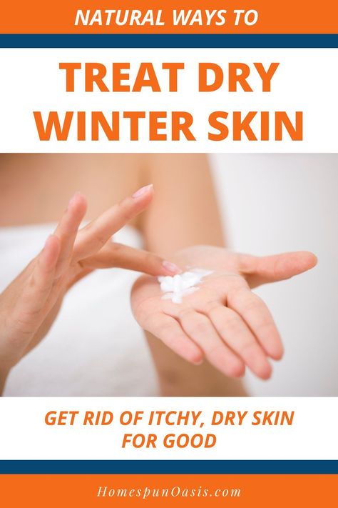 Natural Ways to Treat Dry Winter Skin | Sick of dry skin in the winter? Get rid of your itchy, dry winter skin for good with these natural remedies. Dry Skin Remedies For Body Winter, Dry Skin Home Remedies, Super Dry Skin, Severe Dry Skin, Ski Slope, Extremely Dry Skin, Dry Flaky Skin, Dry Skin On Face, Dry Skin Remedies