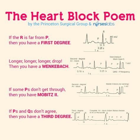 The Heart Block Poem  For more mnemonics, visit our site! http://nurseslabs.com Ekg Interpretation, Nursing Mnemonics, Cardiac Nursing, Nursing School Survival, Heart Blocks, Critical Care Nursing, Nursing School Studying, Nursing School Tips, Nursing School Notes