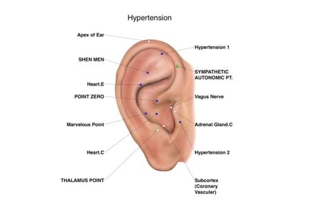 Auriculotherapy FactsBeyondPain Controlto Healing Ear Pressure Points, Ear Acupressure Points, Ear Acupressure, Ear Reflexology, Ear Seeds, Shiatsu Massage Acupressure, Ear Pressure, Shiatsu Massage, Acupuncture Points