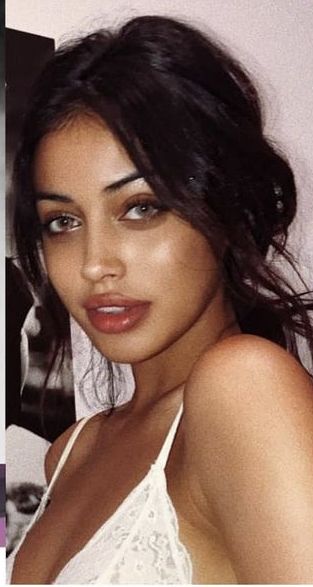 Naturally Bigger Lips, Beautiful Natural Makeup, Burn Makeup, Rhinoplasty Nose Jobs, Lips Inspiration, Face Fillers, Botox Lips, Makeup Contour, Pretty Nose