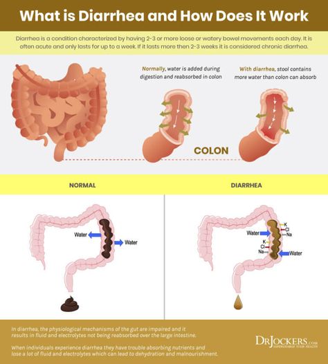 How To Get Rid Of Diaherra, How To Stop Diaherra, Diahrea Remedies, Ileocecal Valve, Indigenous Education, Healing Diet, Gut Issues, Low Stomach Acid, Fluid And Electrolytes