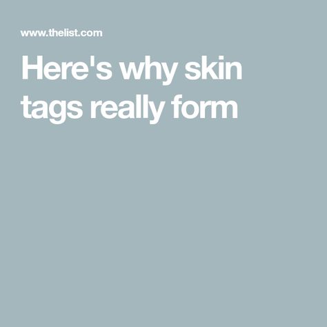 Here's why skin tags really form How To Remove Skin Tags, Skin Tags How To Get Rid Of, Skin Tags Removal Overnight, Skin Tags What Causes, Causes Of Skin Tags, What Are Skin Tags, Detox Your Armpits, Skin Tags On Face, Flat Warts