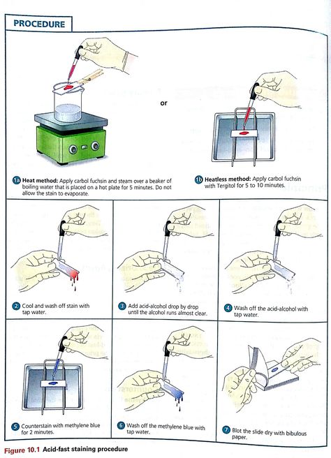 Acid-fast staining procedure Microbiology Laboratory, Medical Microbiology, Microbiology Study, Genetic Modification, Laboratory Techniques, Organic Chemistry Study, Medical Laboratory Technician, Med Lab, Medical Laboratory Scientist