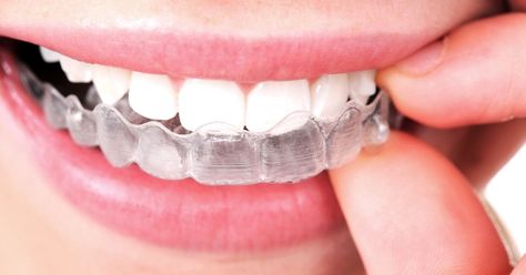 Teeth-straightening startup SmileDirectClub gets $3 billion valuation in new fundraising. Transparent Braces, Invisible Aligners, Clear Aligner, Invisalign Braces, Family Dental Care, Invisible Braces, Clear Braces, Laser Teeth Whitening, Clear Aligners