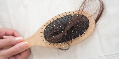 @Insider: how you can tell if your #hairloss is a sign of something more serious. Telogen Effluvium, Strands Of Hair, Hair Falling, Female Pattern Baldness, Hair Falls, Androgenetic Alopecia, Reduce Hair Fall, Male Pattern Baldness, Hair Growth Supplement