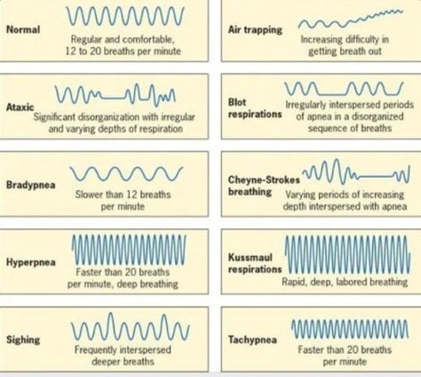 Respiratory Patterns Veterinary Anaesthesia, Medic School, Paramedic Study, Nursing Tools, Science Diy, Paramedic Student, Paramedic School, Medical Notes, Brain Book