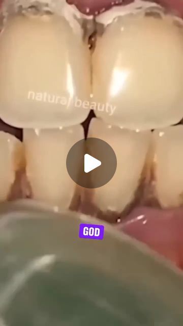 Lose Weight on Instagram: "Remove Tartar and Yellowness From Your Teeth 
Follow @womanbodytip 
#teethwhitening #yellowteeth #remedy #naturalremedies" Remove Tartar From Teeth At Home, Tumeric Teeth Whitening, Tartar Teeth, Natural Teeth Whitening Diy, Teeth Covers, Tartar Removal, Teeth Whitening Diy, Yellow Teeth, Privacy Fence Designs