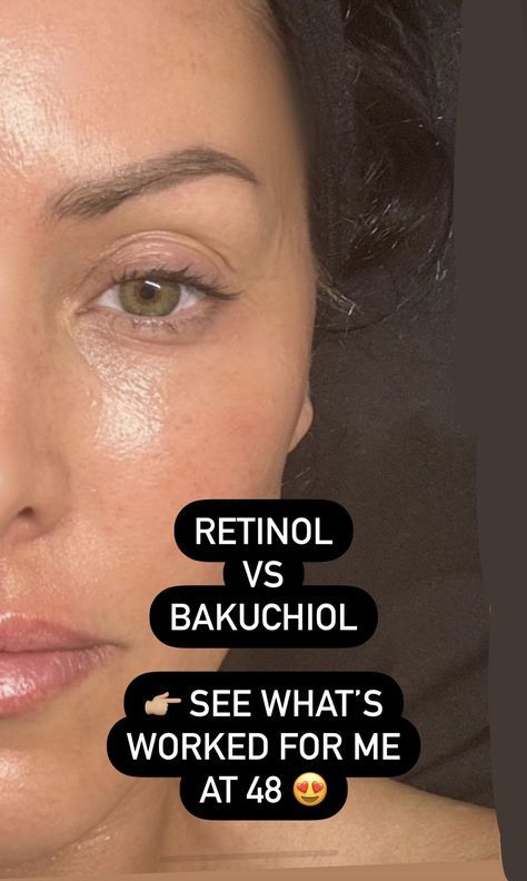 See the pros and cons of both retinols and bakuchiol oil. They work in a similar way. I'm 48 and have been testing skincare for years. See my review on them both. What Causes Pimples, Bio Oil Before And After, Hobbies To Learn, Routine Goals, Retinol Benefits, Face Beauty Tips, Working On Me, Simple Skincare Routine, Face Exercises