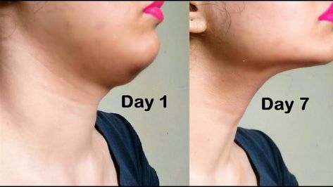 After doing this consistently for 2 weeks her ‘double-chin’ is gone! Surgery is absolutely not needed for you to restore your charming face. Even if you are ... Reduce Double Chin In A Week, Reduce Double Chin Fast, Exercise To Reduce Double Chin, Excersise To Loose Double Chin, Face Fat Loss Double Chin How To Get Rid, Rid Of Double Chin, Reduce Face Fat, Face Fat, Face Exercises