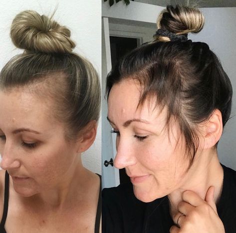 MONAT products are guaranteed to help Mama’s with their post partum hairloss no matter the severity of the loss or thinning. Hair Lossing, Pregnancy Hairstyles, Losing Hair, Postpartum Hair, Hair Fall Solution, Hair Growing Tips, Tips Hair, Hair Growing, Monat Hair