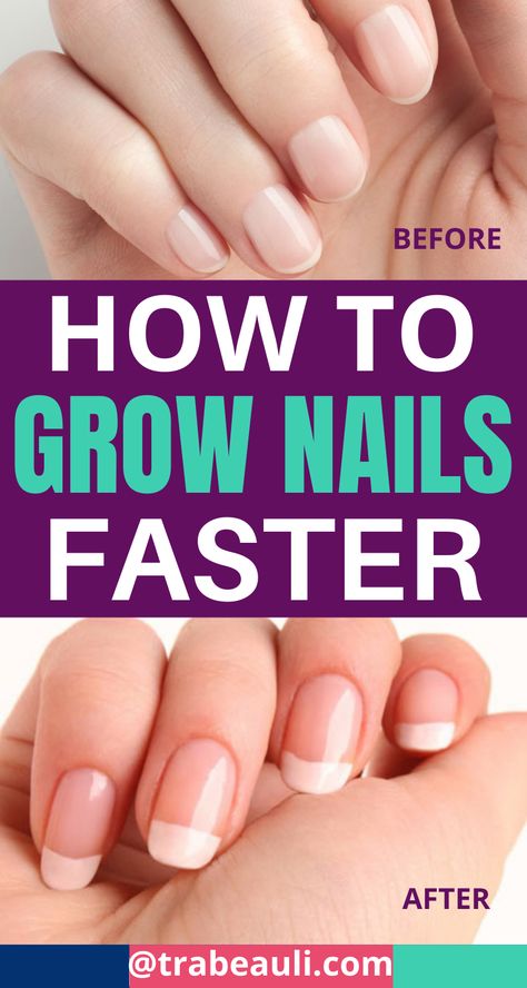 HOW TO GROW NAILS FASTER WITH NATURAL WAYS IN (ONE WEEK) Nail Growth Faster, Grow Long Nails, Nail Growth Tips, Grow Nails Faster, Fast Nail, Food Nails, Tongue Health, Nail Care Tips, How To Grow Nails