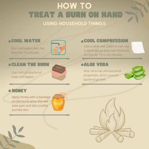 How to Treat a Burn on Hand From Hot Pan - Using Household Things How To Treat Burns Skin, Treating Burns Remedies, How To Heal Burned Skin, How To Help A Burn On Hand, How To Heal A Burn Quickly, Burn Care Home Remedies, Burn Remedies Hand, Diy Burn Relief, How To Treat A Burn Skin