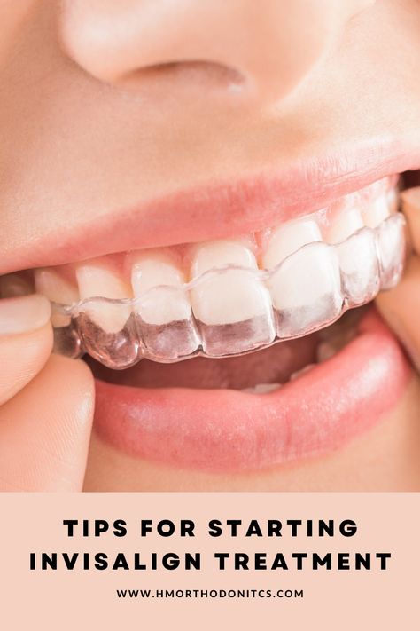 Clear Aligner, Invisalign Aligners, Invisalign Braces, Teeth Alignment, Invisible Braces, Clear Braces, Teeth Straightening, Clear Aligners, Teeth Braces