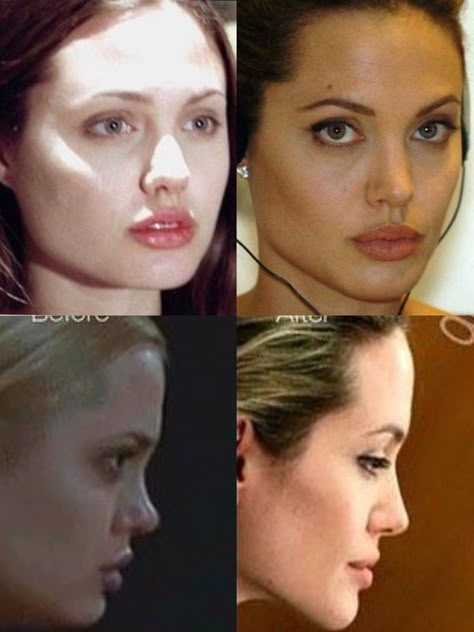 #angelinajolie #plasticsurgery #beforeandafter #monicabellucci #jenniferconnelly #hollywood #gia #girlinterrupted #90s #90sbeauty Prominent Nose Women, Angelina Jolie Surgery, Angelina Jolie Nose, Angelina Jolie Plastic Surgery, Angelina Jolie 90s, Celebrity Surgery, Plastic Surgery Fail, Glasses For Round Faces, Sherilyn Fenn