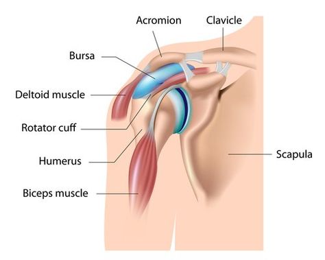 Illustration of Shoulder bursa, and bursitis. Torn Labrum Shoulder, Subacromial Bursitis, Torn Labrum, Bursitis Shoulder, Shoulder Anatomy, Shoulder Rehab, Shoulder Impingement, Rotator Cuff Tear, Rotator Cuff Injury