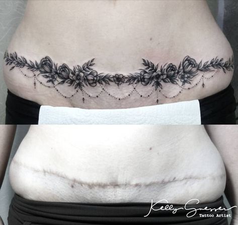 C Section Scar Tattoo, Lower Belly Tattoos, Abdomen Tattoo, Tummy Tattoo, Tattoo Over Scar, Stomach Tattoos Women, Scar Cover Up, Waist Tattoos, Tattoos To Cover Scars