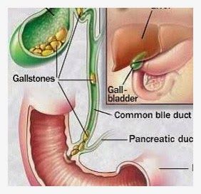 Gallbladder Attack, Gallbladder Cleanse, Gallbladder Surgery, Nuclear Medicine, Bile Duct, Human Body Anatomy, Medical Anatomy, Body Anatomy, Medical Knowledge