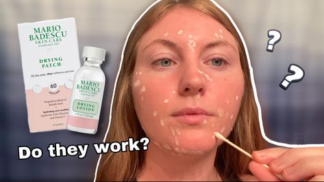 Does the Mario Badescu Drying Lotion and Drying Patches work? Watch the video to find out! *Spoiler Alert* they do! Mario Badescu Drying Lotion, Drying Lotion, Work Watch, Mario Badescu, Spoiler Alert, One Week, Youtube Videos, Lotion, Mario