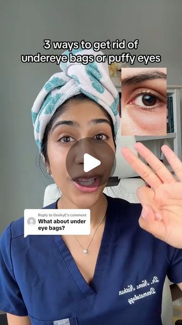 Dr. Neera Nathan on Instagram: "How to get rid of puffiness or eye bags caused by fluid retention. These are generally worse in the morning and swell with allergies, poor sleep or salty foods. Under eye bags or puffy eyes from fat require removal. #undereyebags #puffyeyes #fyp #dermatologist #darkcircles" Puffy Eyes Remedy How To Get Rid, How To Get Rid Of Under Eye Bags Fast, Under Eye Bags Makeup, Puffy Eyelids How To Get Rid Of, How To Fix Under Eye Bags, How To Get Rid Of Puffy Under Eyes, Dark Puffy Circles Under Eyes, Eye Bags Makeup Look, How To Get Rid Of Eye Bags Naturally