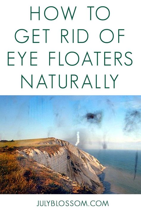 With these 7 natural remedies for eye floaters, you may be able to reduce or get rid of those vision disturbances! Eye Health Remedies, Eye Floaters, Anti Oxidant Foods, Eye Pain, Facial Steaming, Eye Sight Improvement, Eye Exercises, Essential Oil Mixes, All Nighter