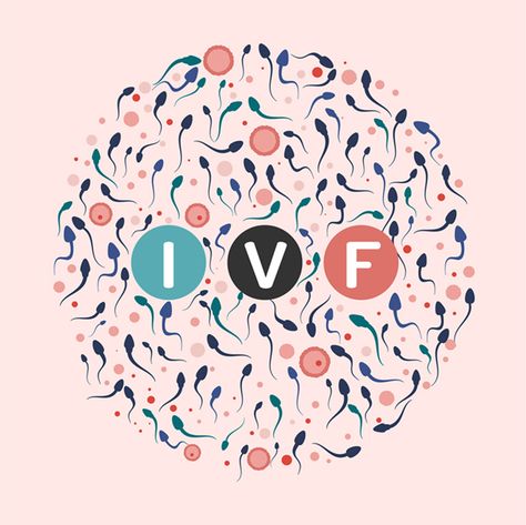 How is IVF Done—Step by Step? - ARC Fertility Embryo Implantation, Ivf Failure, Ivf Success Rates, Ivf Procedure, Ivf Cost, Assisted Reproductive Technology, Fertility Problems, Ivf Cycle, Ivf Success