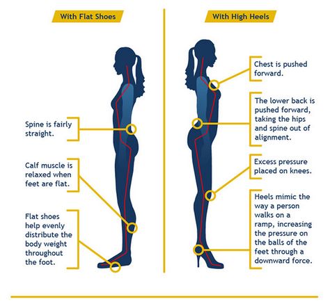 The Spine Institute of Florid Height Insoles, Workout Results, Foot Spa, Body Posture, Beautiful High Heels, Muscle Fatigue, Laser Therapy, Calf Muscles, Dermal Fillers