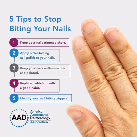 Repeated nail biting can lead to tissue damage and leave you vulnerable to infection. Kick the habit with these dermatologist tips: Stop Biting Your Nails, Nail Biting Habit, Make Nails Grow, Biting Nails, Antifungal Cream, Nail Infection, Nail Biting, Nail Growth, Strong Nails