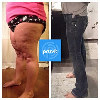 Ketones Pruvit Before And After, Pruvit Ketones Before And After, Ketones Pruvit, Keto Mcdonalds, Pruvit Ketones, Pruvit Keto Os, Pruvit Keto, So Emotional, Keto Os