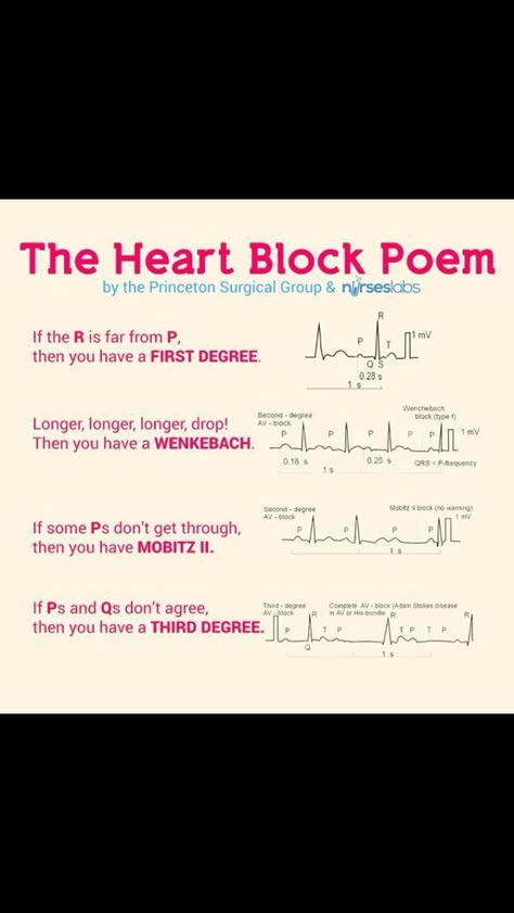 Ekg Interpretation, Nursing Mnemonics, Cardiac Nursing, Pa School, Critical Care Nursing, Heart Blocks, Nursing School Survival, Nursing Life, Being A Nurse