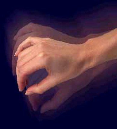 All that is to know about Benign Essential Tremor | Natural Herbs Clinic Therapy Ideas For Adults, Imperfections Art, Tardive Dyskinesia, Chronic Inflammatory Demyelinating Polyneuropathy, Demyelinating Disease, Hand Tremors, Tremors Hand, Essential Tremors, Huntington's Disease