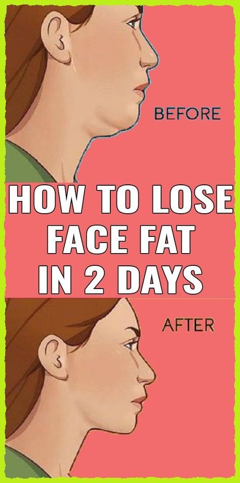 Reduce Face Fat, Double Chin Exercises, Reduce Double Chin, Chin Exercises, Muscle Stretches, Natural Face Lift, Face Fat, Keto Diets, Face Exercises