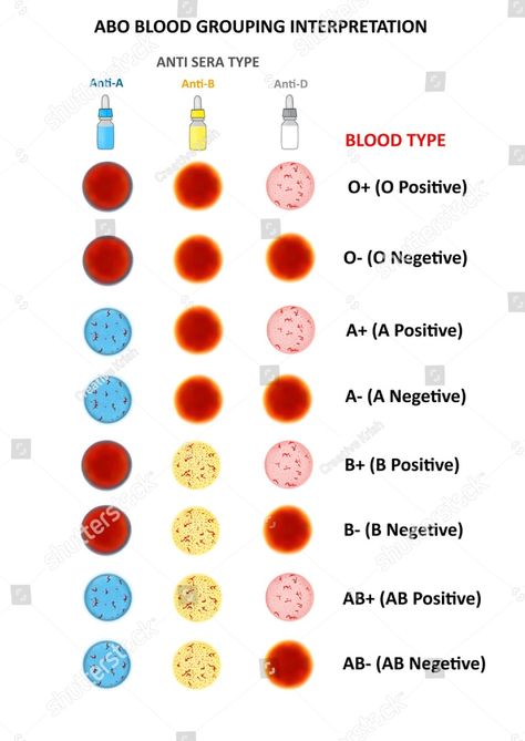 Laboratory Tests Medical, Physiology Wallpaper, Medical Laboratory Aesthetic, Medtech Student, Way To Draw People, Phlebotomy Study, Medical Laboratory Science Student, Medical Laboratory Technician, Learn Biology