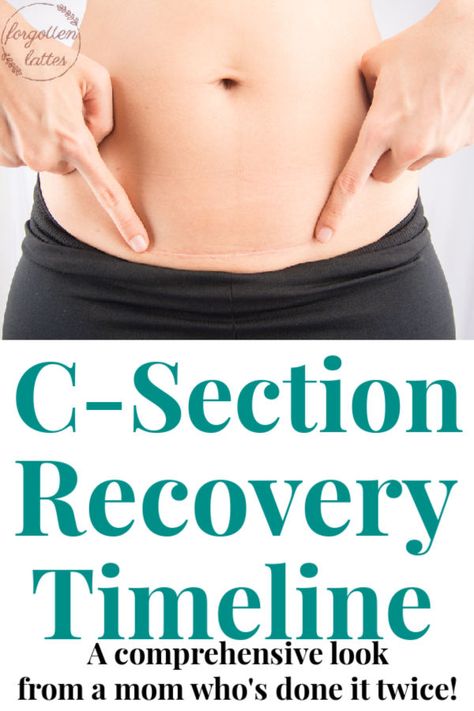 I really appreciated this c-section recover timeline after my emergency delivery. The timeline gave me solid idea of what to expect during my postpartum recovery. #csectionrecoverytimeline #postpartumrecovery C Section Recovery Timeline, Post C Section, C Section Workout, Birth Recovery, C Section Recovery, Pregnancy Information, Postpartum Body, Twin Pregnancy, Pregnancy Health