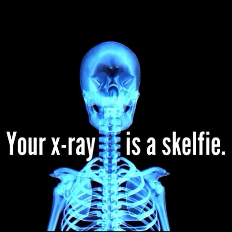 Skelfie! Get it? #GetAdjusted #Checkingthecause Medische Humor, Chiropractor Humor, Chiropractic Humor, Medical Assistant Humor, Xray Humor, Medical Cookies, Radiology Humor, Chiropractic Quotes, Chiropractic Marketing