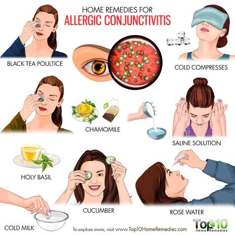 Home Remedies for Allergic Conjunctivitis | Top 10 Home Remedies Pinkeye Remedies, Allergy Eyes, Home Remedies For Allergies, Top 10 Home Remedies, Natural Remedies For Allergies, Sick Remedies, Allergy Remedies, Itchy Eyes, Pink Eye