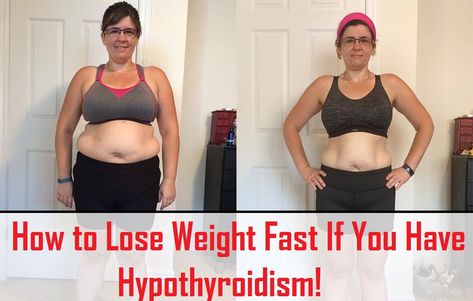 How to Lose Weight Fast If You Have Hypothyroidism? Fast Fat Burning Workout, Hormonal Weight Gain, Ways To Loose Weight, How I Lost Weight, Weight Problems, Losing Weight, Weight Gain