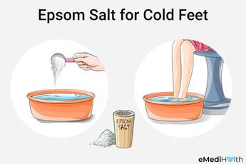 5 Home Remedies for Cold Feet & How to Use Them Ovary Pain, Home Remedies For Cold, Poor Circulation, Natural Healing Remedies, Always Cold, Cold Home Remedies, Cold Remedies, Amazing Home, Improve Blood Circulation