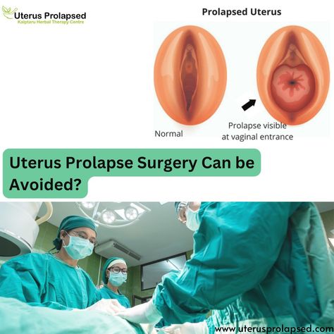 Polyps Uterus, Retroverted Uterus, Prolapsed Uterus, Ham Bone Soup, Uterine Prolapse, Pelvic Muscles, Bone Soup, Herbal Therapy, Pelvic Organ Prolapse