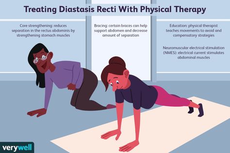 Diastasis Recti Physiotherapy Are These Contents Helpful? Many thanks for sharing your thoughts! Sorry to hear this. Do let us know if you have any suggestions for improving this content. We are grateful. Your feedback has been sent. American Physical Therapy Association believes consumers need to have information available that can help them make informed… Continue reading Diastasis Recti Physiotherapy Rectus Abdominis Muscle, Healing Diastasis Recti, Stability Exercises, Core Strengthening Exercises, Stomach Muscles, We Are Grateful, Muscle Power, Strengthen Core, Healthy Body Weight