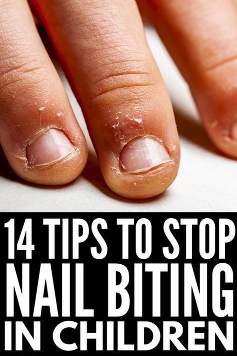 How to Get Kids to Stop Biting Their Nails: 14 Tips for Parents Nail Biting Remedies For Kids, How To Stop Biting Your Nails Tips, Nail Biting Remedy For Adults, French Tip Nails For Kids, Nail Biting Remedies, Nail Chewing, Biting Fingernails, Stop Nail Biting, Nail Biting Habit