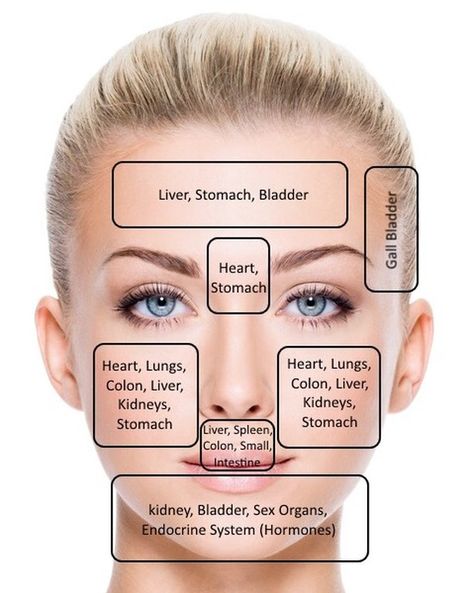 Im having breakouts under at the bottom of my cheeks. I love this face map to get to the bottom of what needs more love in my body. Kidney failure & problems are an issue for burn survivors so it looks like a healthy dose of cranberry juice and working through anger surfacing aka fear will do the trick. Did you know blemishes are the emotion of anger surfacing? Its so cool to me how our body sends us messages like a map to what it needs. XOXO #skin #skincare #acne #glow Pimple Remedies Overnight, Doterra Acne, Gesicht Mapping, Endocrine System Hormones, Pimple Remedies, Acne Recipes, Face Map, Skin Breaking Out, Face Mapping Acne