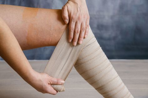 What Does the Start of a Venous Ulcer Look Like? Water Retention Remedies, Compression Therapy, Leg Ulcers, Venous Insufficiency, Swollen Legs, Fluid Retention, Compression Stockings, Water Retention, Calf Muscles