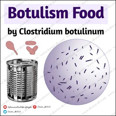 Clostridium botulinum - Botulism Food Poisoning Food Microbiology, Microbiology Notes, Clostridium Botulinum, Food Poisoning, Microbiology, Science, Quick Saves