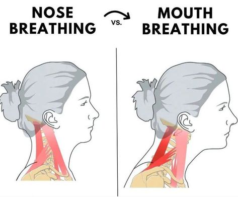 2nd Degree Burns, Neck Posture, Respiratory Alkalosis, Mouth Breather, Degree Burns, Iv Fluids, Domino Effect, Medical University, Money Maker