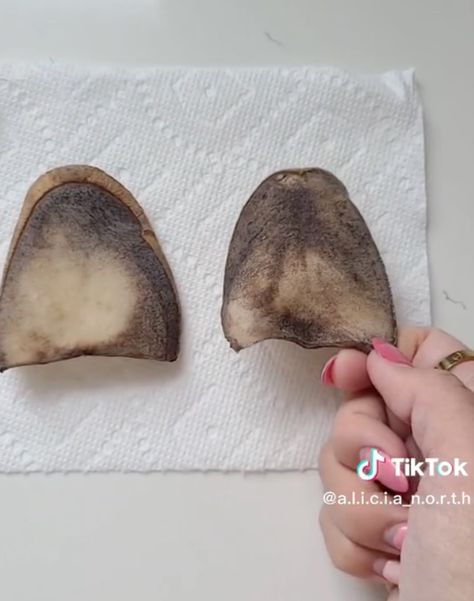 ‘Potatoes in socks’ flu remedy shocks TikTok: ‘What came out of my body?’ Potato Sickness Remedy, Sick Remedies Body Aches, Garlic In Socks Sleep, Potatoe On Feet For Sickness, Potato In Socks For Sickness, Wet Socks For Cold, Onion On Feet For Cough, Potato In Sock Remedy, Potato Sock Remedy