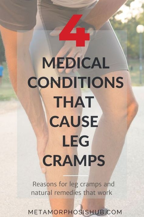 Not all leg cramps are caused by over exertion or electrolyte deficiencies. They may be caused by these medical conditions...............more on website #SeniorCare #legcramps #legs #health #medical Leg Pain Relief Remedies, Severe Leg Cramps, Leg Cramps Causes, Nerve Pain Remedies, Leg Cramps At Night, Calf Cramps, Pain Relief Remedies, Nerve Health, Get Rid Of Pimples