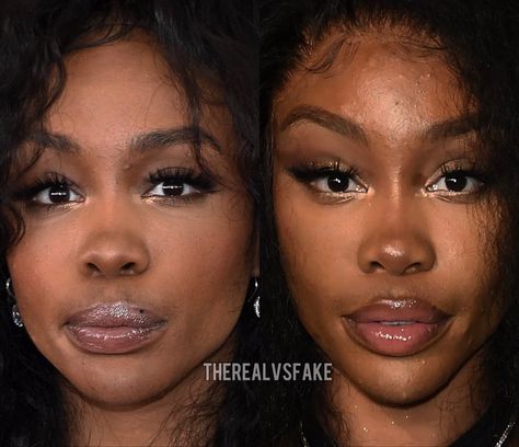 Sza Makeup Nose, Sza Singer Before And After Surgery, Sza Singer Nose Contour, Mariah Carey Makeup, Bad Nose Jobs, Ethnic Rhinoplasty, Nose Fillers, Sza Singer, Rhinoplasty Nose Jobs